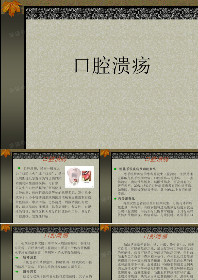 口腔溃疡 ppt课件