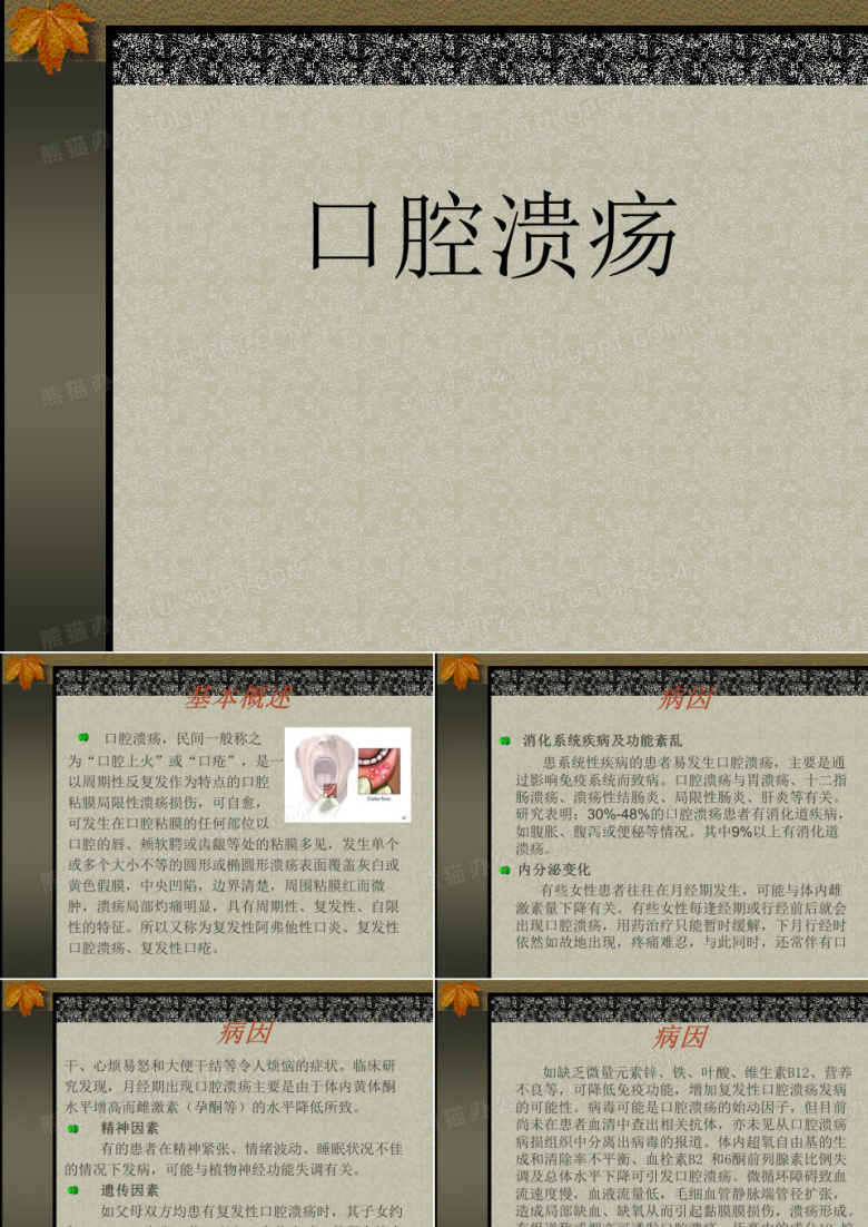 口腔溃疡