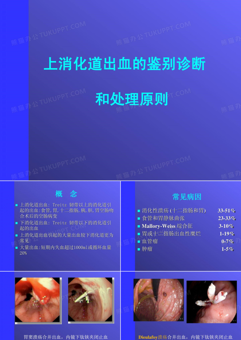 消化道出血