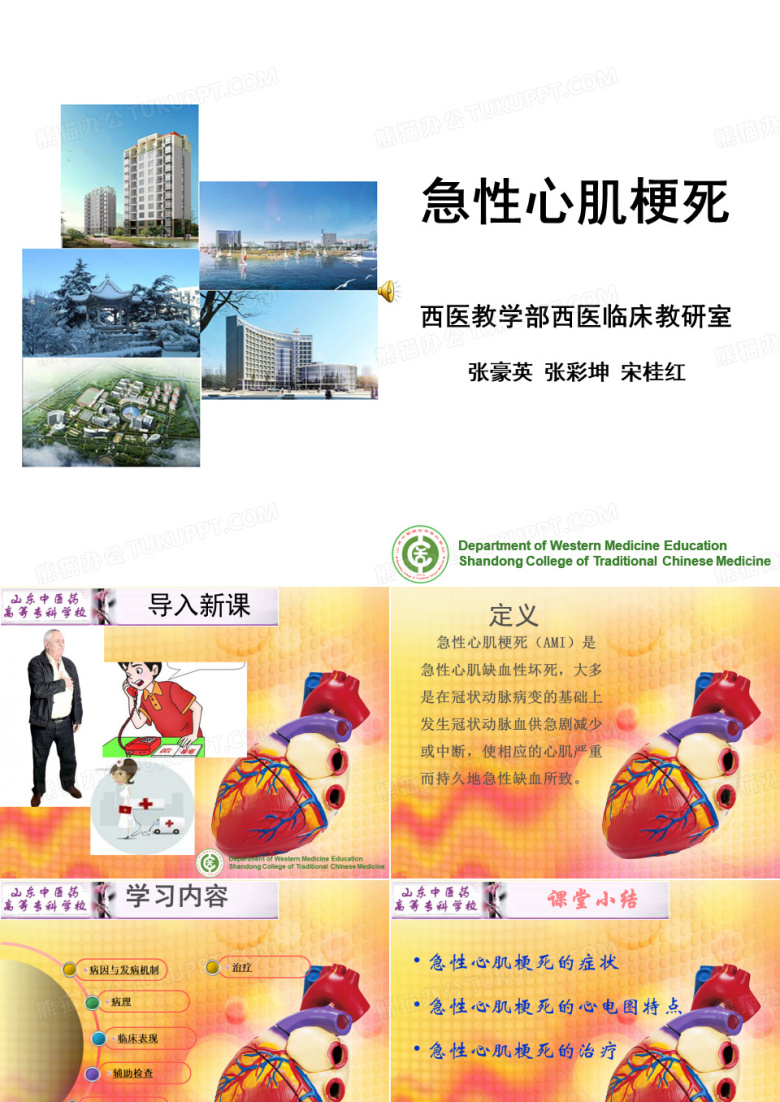 急性心肌梗死