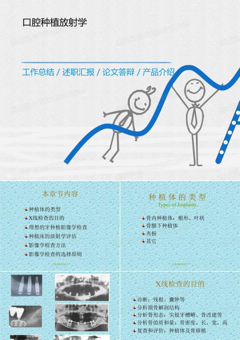 口腔种植放射学