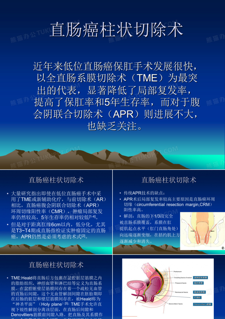 直肠癌柱状切除术(修改版)