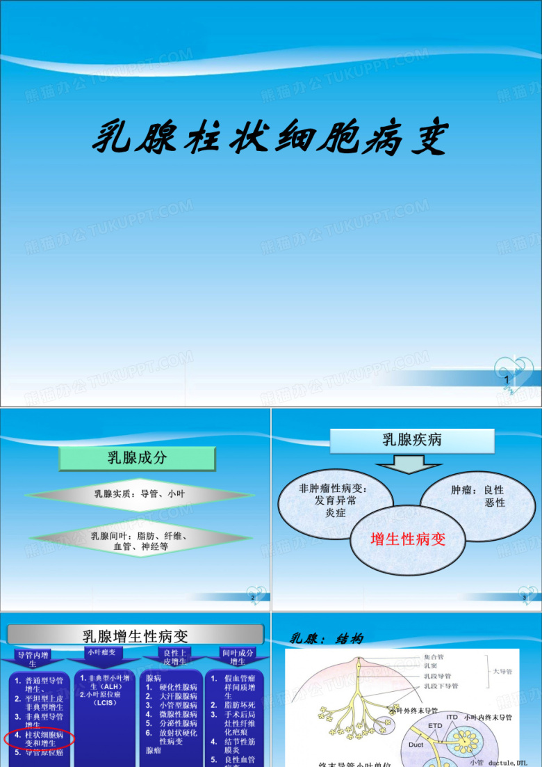 乳腺柱状细胞病变