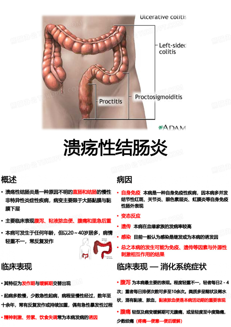 溃疡性结肠炎