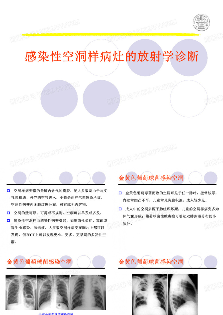 感染性空洞样病变的放射学诊断