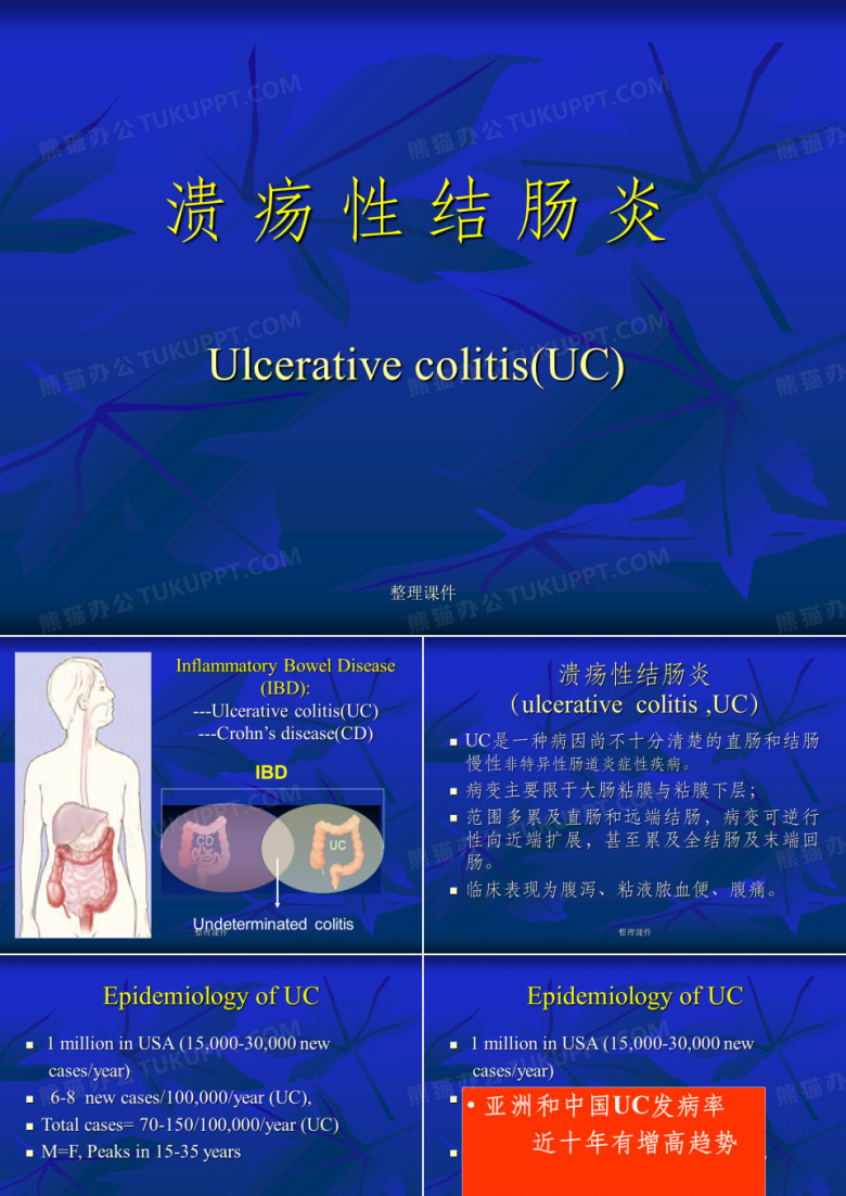 《溃疡性结肠炎》