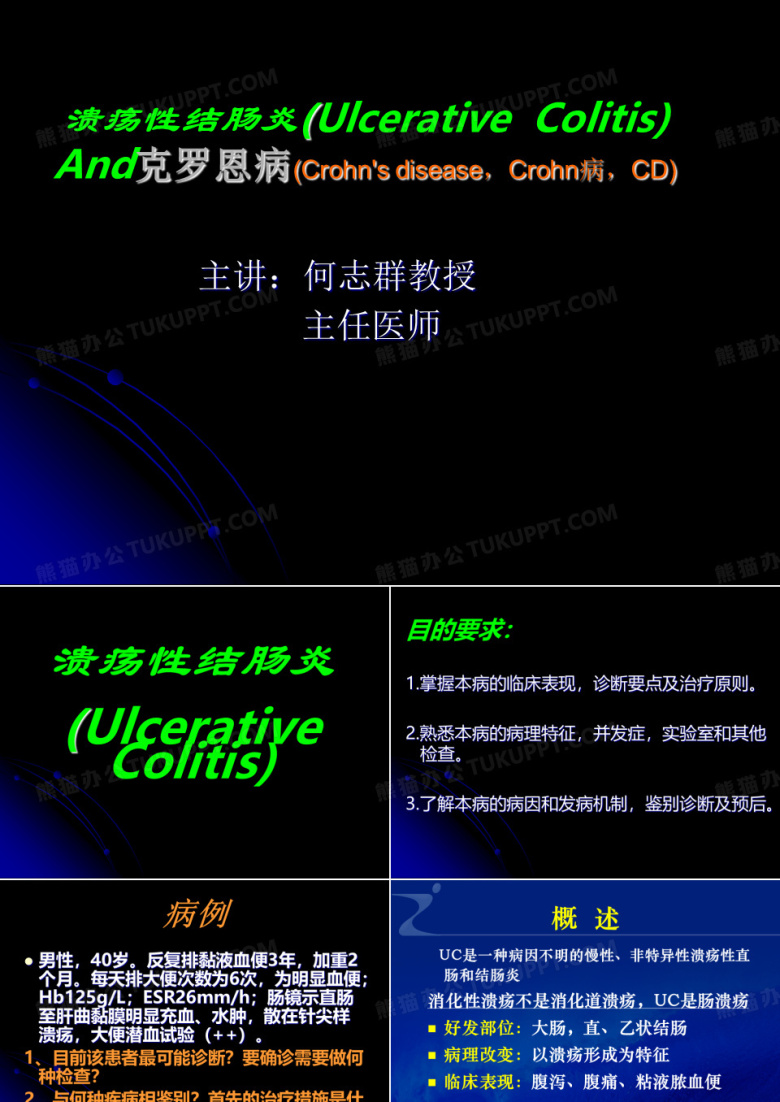 溃疡性结肠炎
