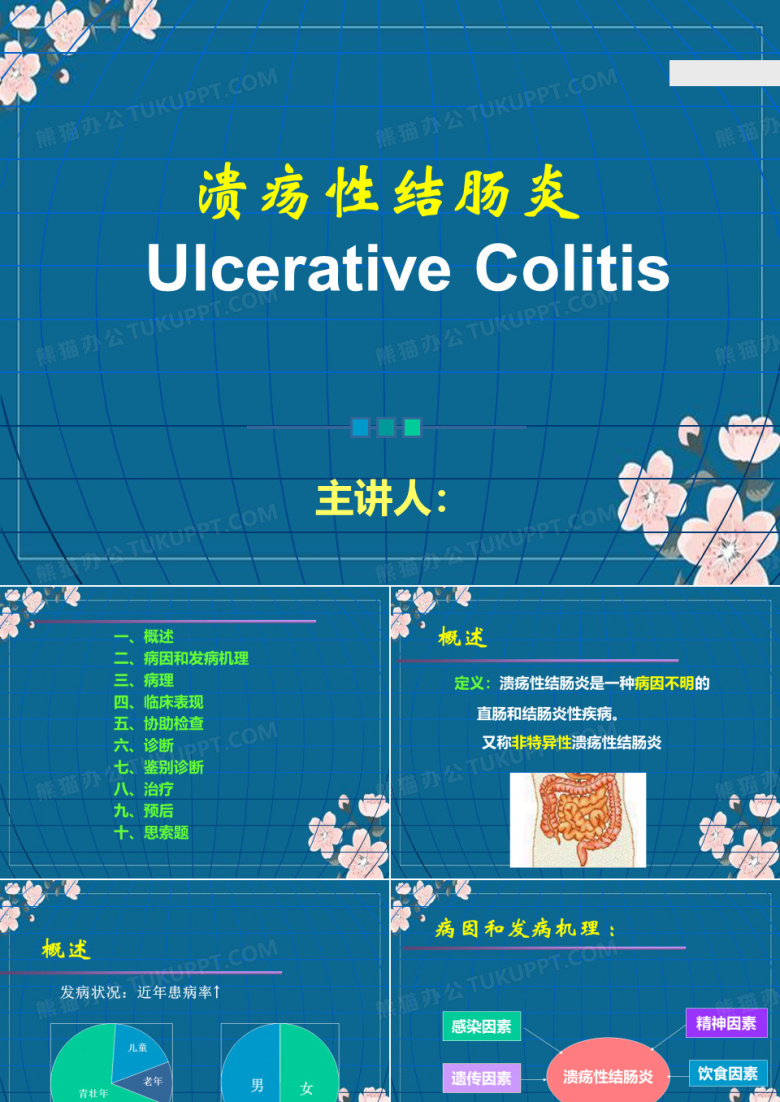 溃疡性结肠炎