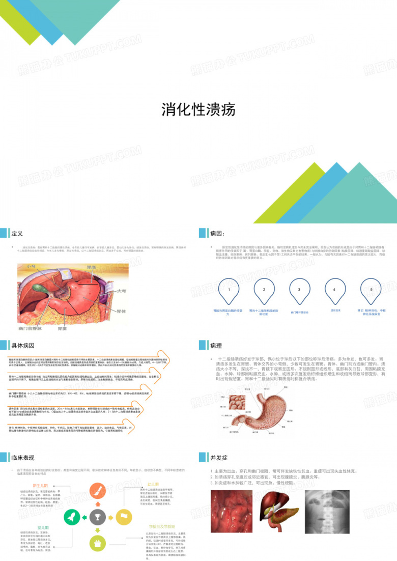 消化性溃疡