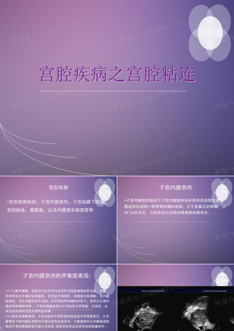宫腔粘连