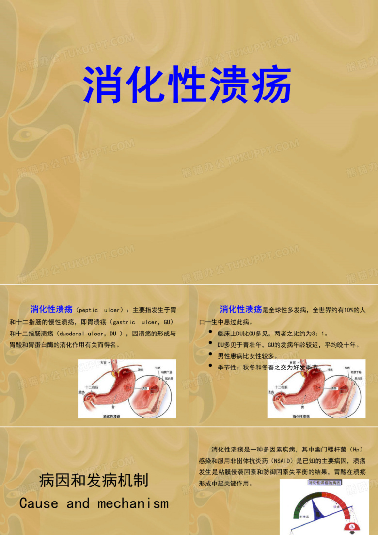 消化性溃疡