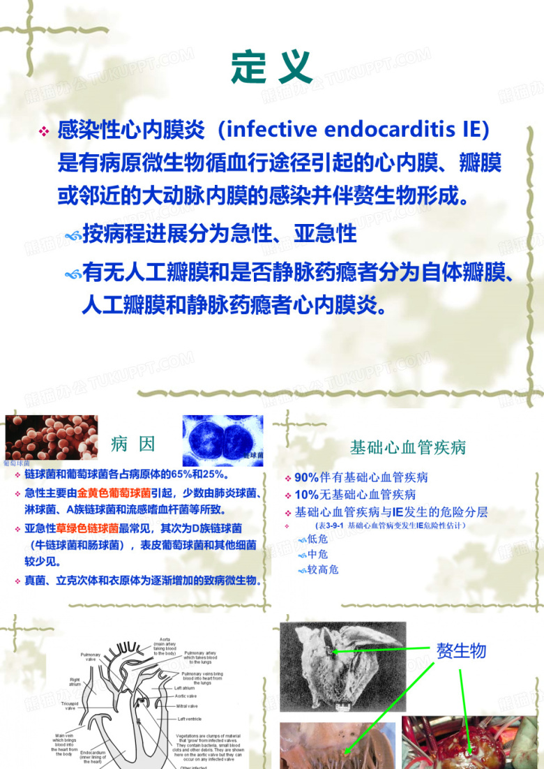 感染性心内膜炎
