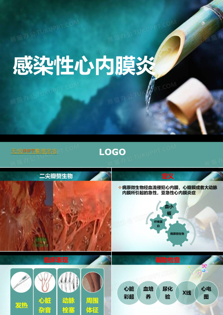 感染性心内膜炎
