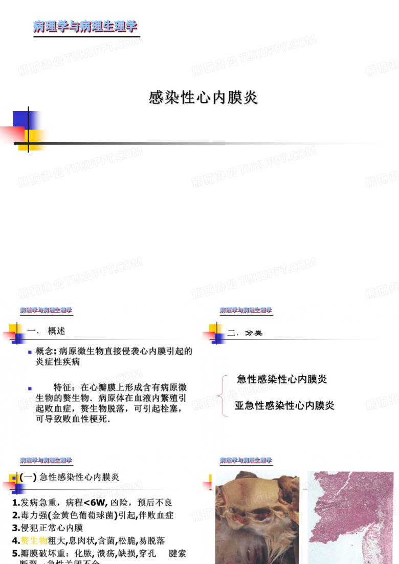感染性心内膜炎
