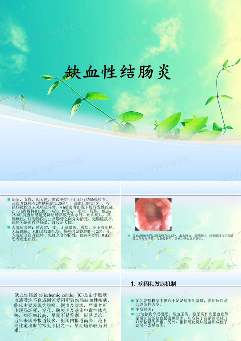 缺血性结肠炎