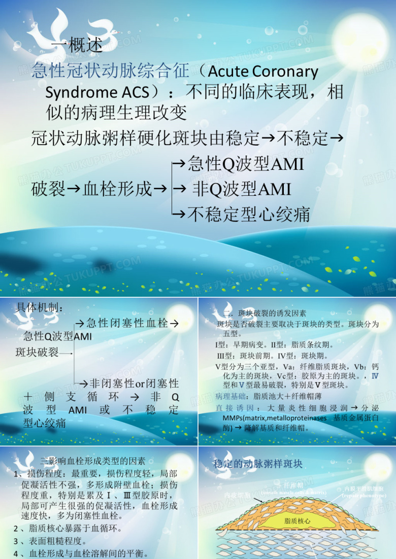 急性冠脉综合征课件