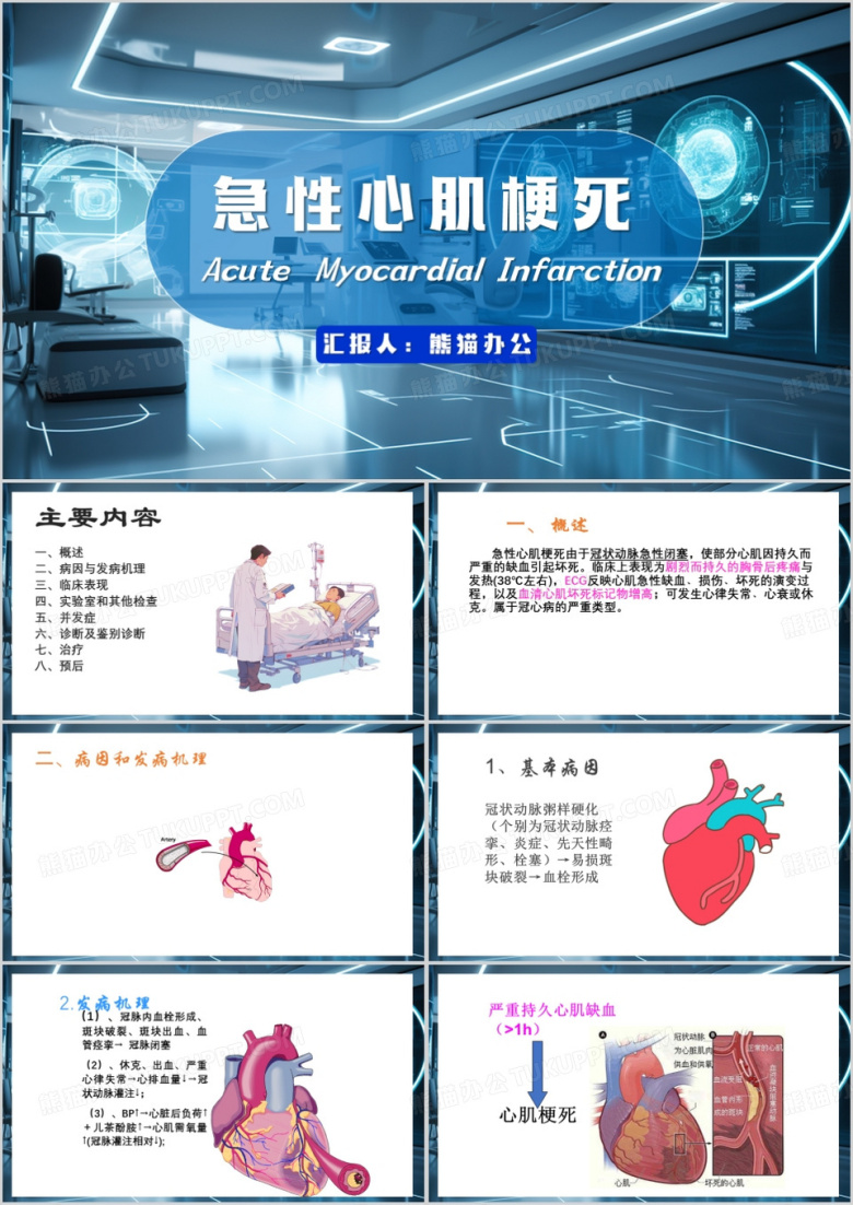 蓝色卡通风急性心肌梗死PPT模板