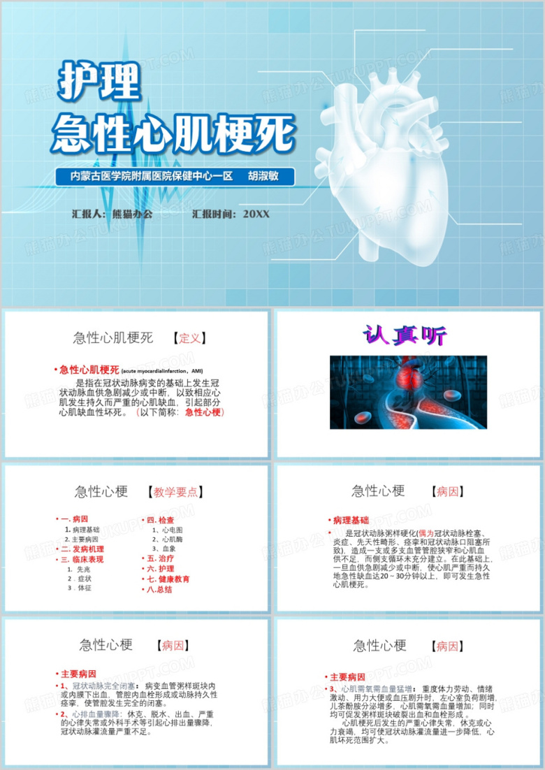 蓝色简约风急性心肌梗死PPT模板