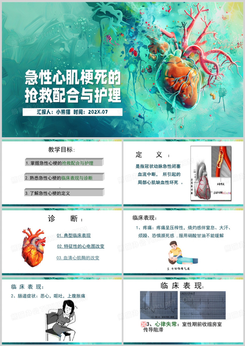 绿色简约风急性心肌梗死PPT模板