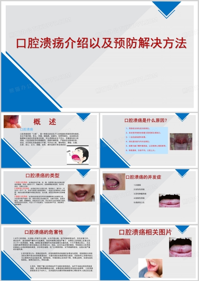口腔溃疡的介绍以及预防改善方法